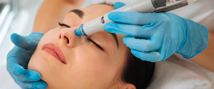 Microneedling
